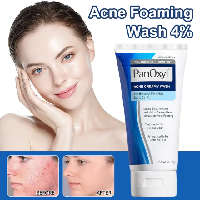 PanOxyl® Acne Creamy Wash Benzoyl Peroxide 4% 156g - Classy Touch Pk